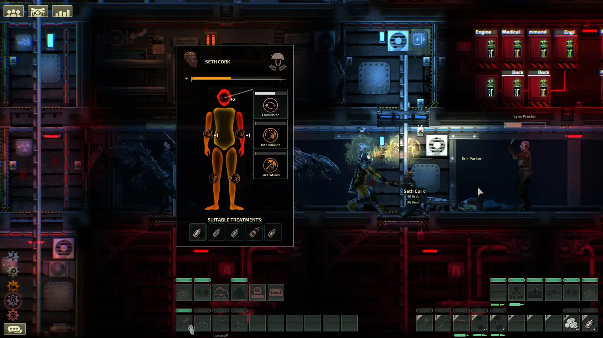 Barotrauma media 5
